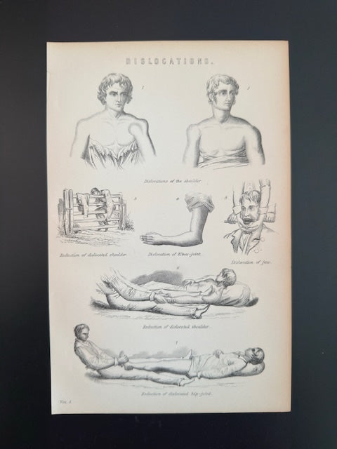 Anatomical diagram of a various body parts and anatomy scientific engraving on a black background